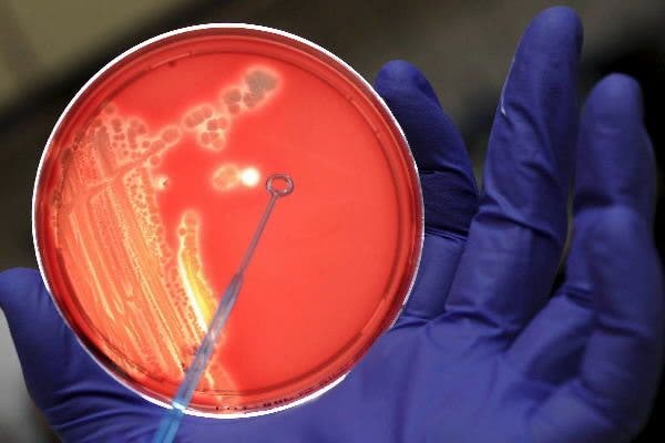 Cultivo de bacterias. Marius Becker/ EFE