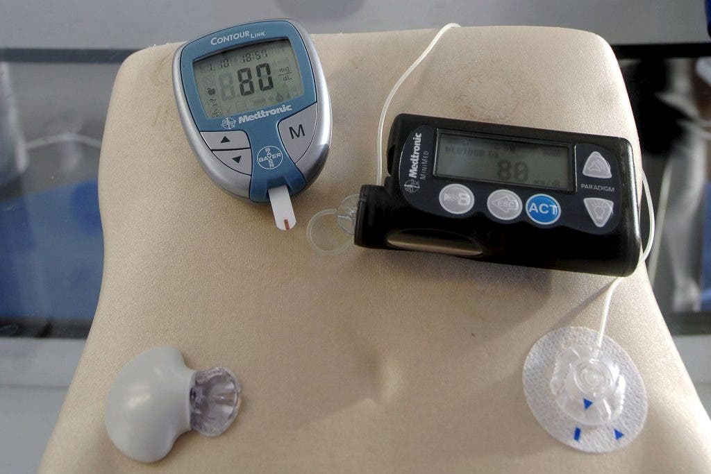 Bomba de Diabetes