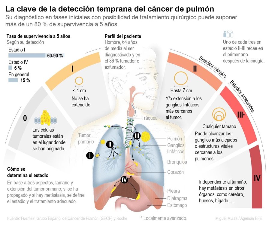 cáncer pulmón tratamientos