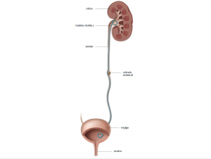 cateterismo ureteral
