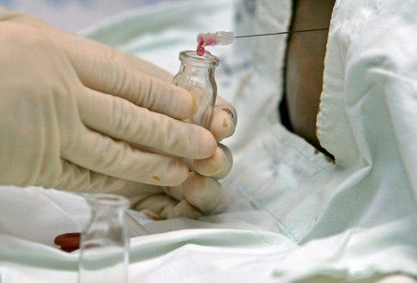 cáncer hematológico COVID-19