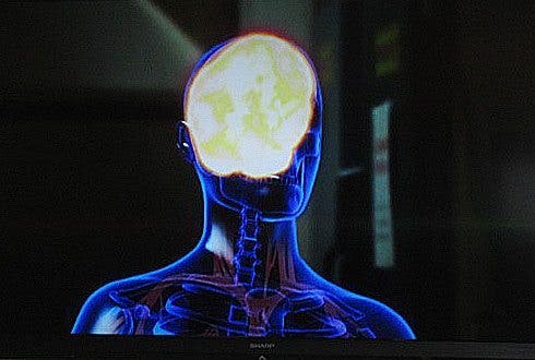 Enfermedad de Tay-Sachs