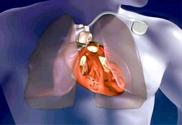 salud cardiovascular