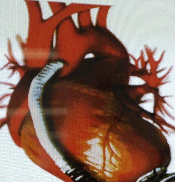 Imagen de un corazón