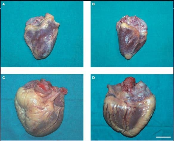 Corazón