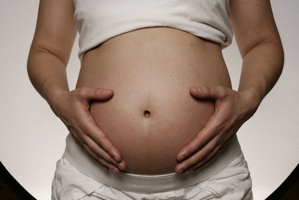 diastasis abdominal