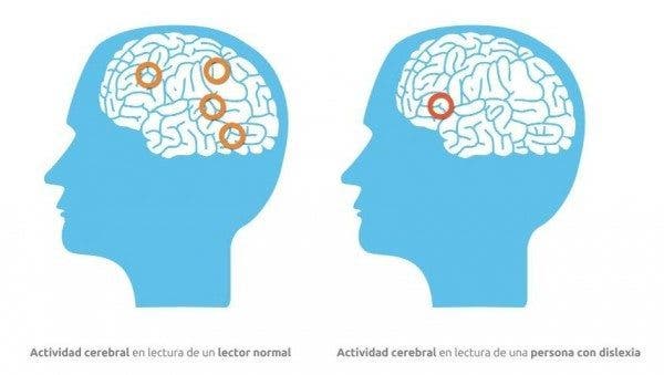 cerebro