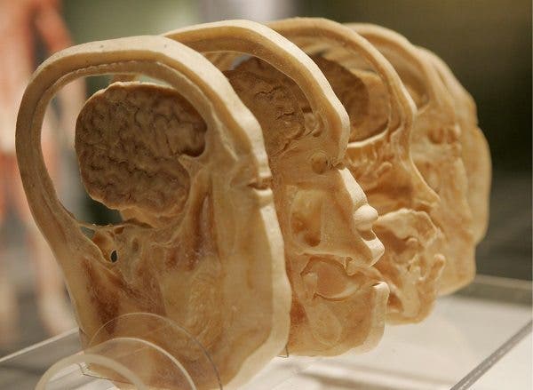 Imagen de las secciones transversales de un cráneo y cerebro humano. EFE/STEFAN ZAKLIN