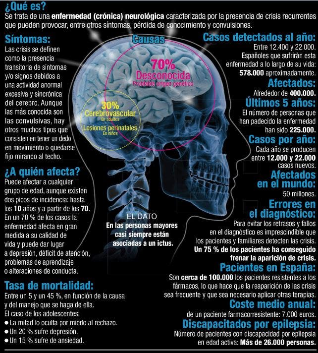 epilepsia