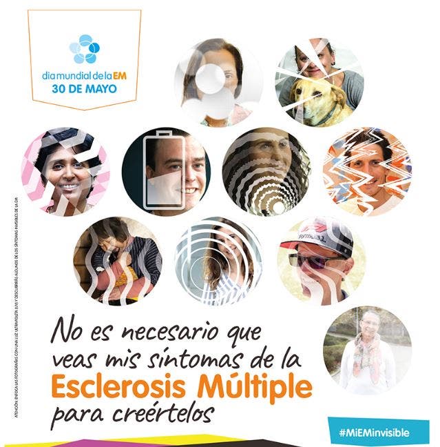 esclerosis múltiple síntomas