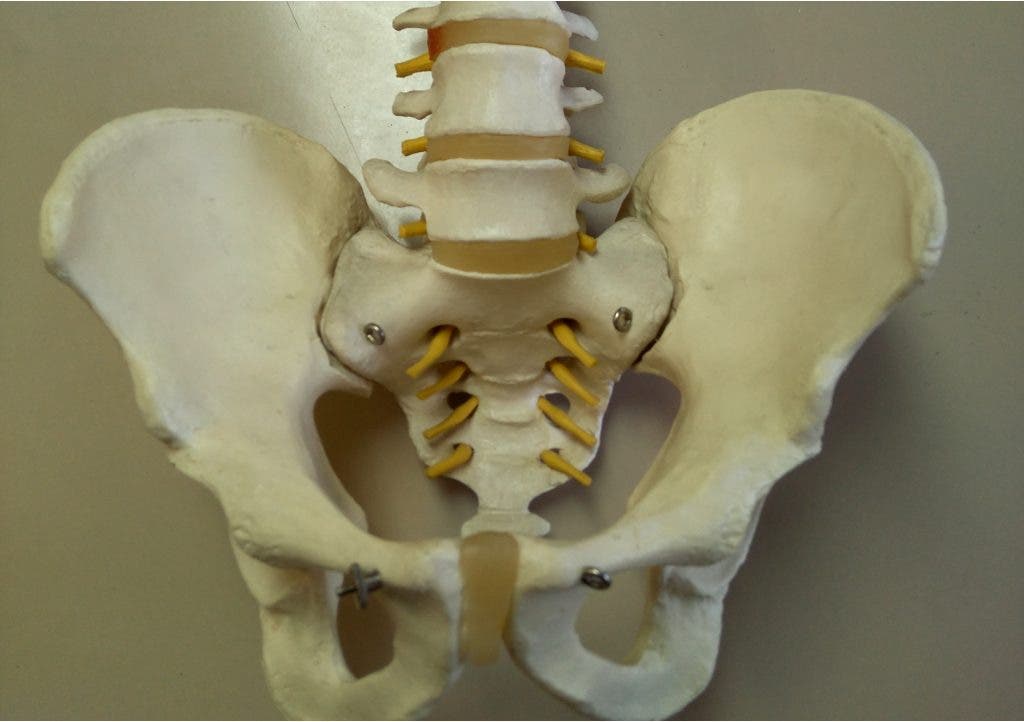 espondilitis anquilosante vertebras