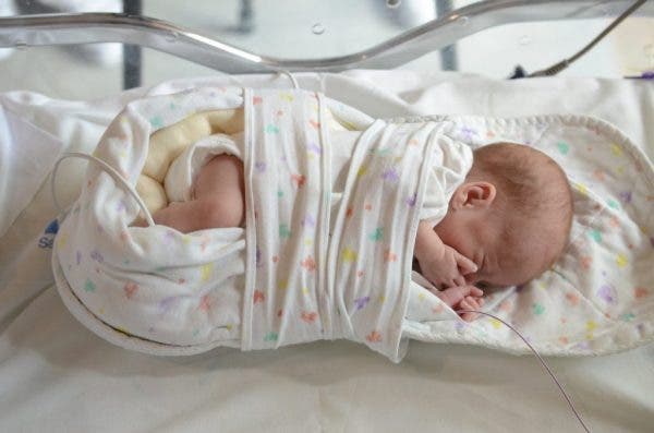bebé prematuro