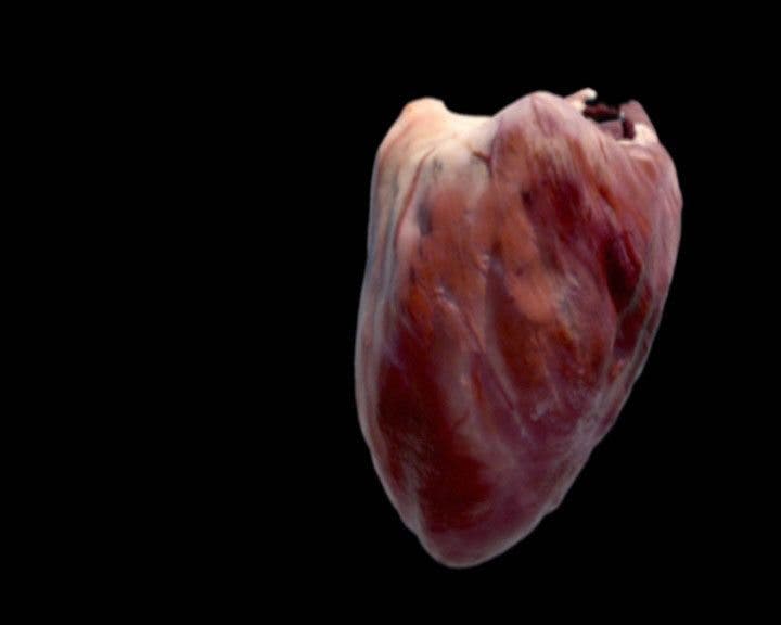 simulación exacta corazón