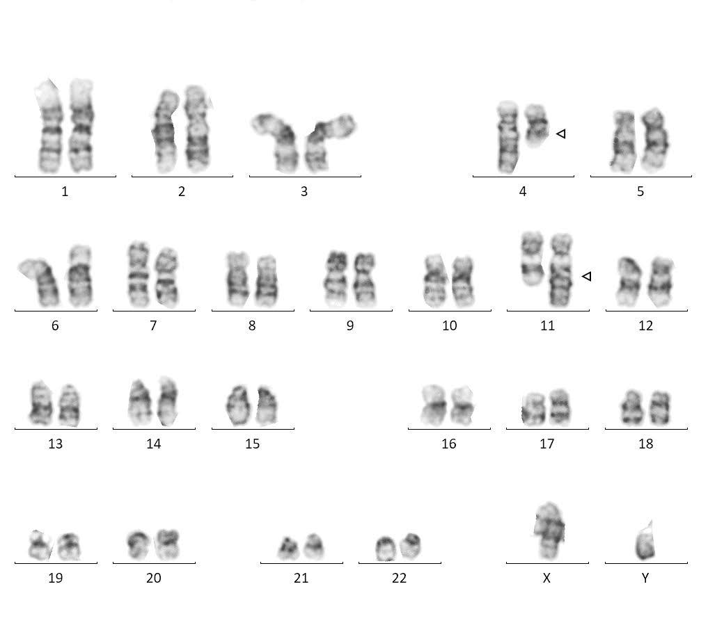 CRISPR cáncer