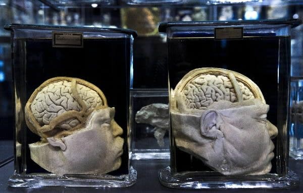 gimnasia cerebro