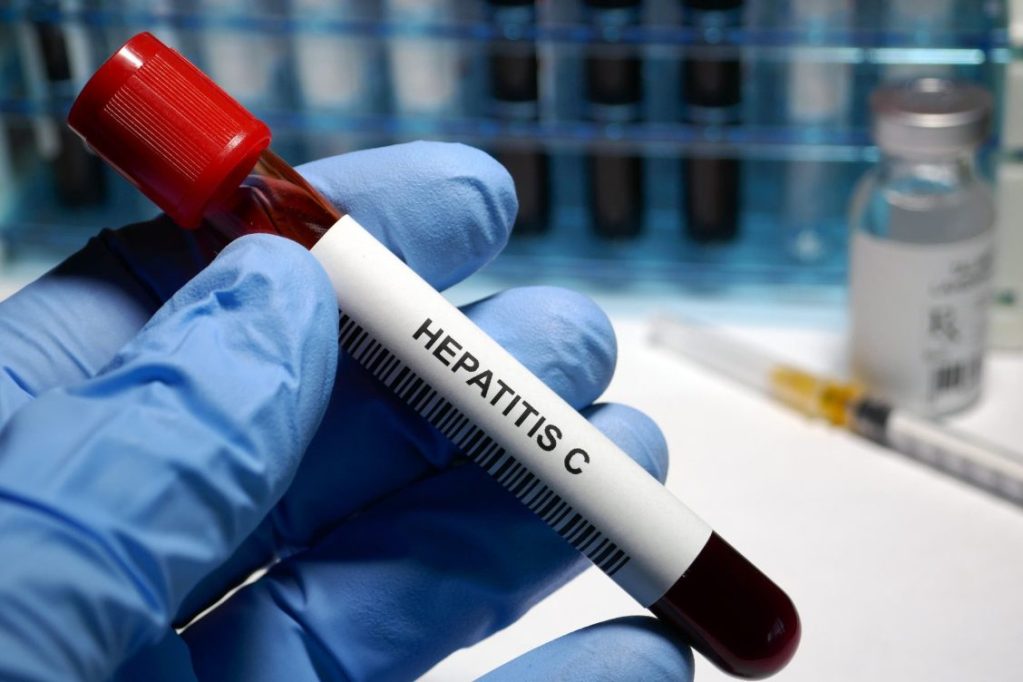 diagnóstico hepatitis