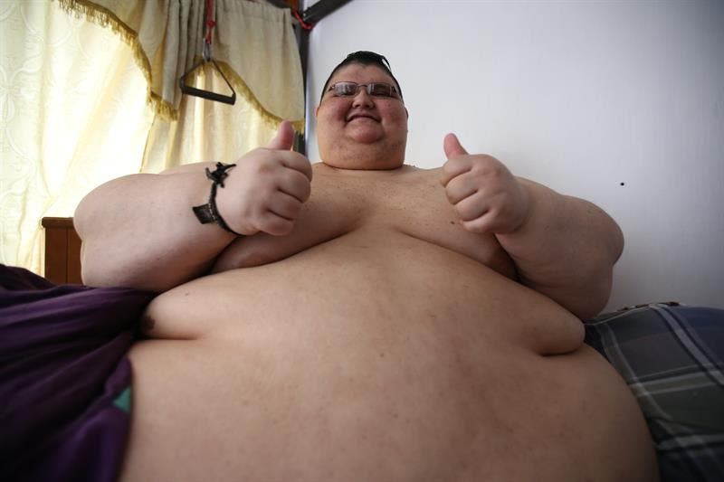 hombre más obeso del mundo