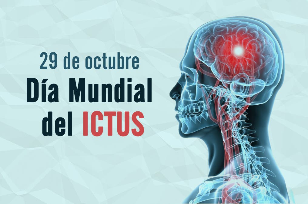 ictus riesgo