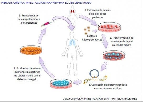 Fibrosis quística
