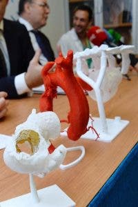 insuficiencia, cardiaca, miocardio, infarto, corazón, cardiología