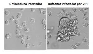 VIH, enfermedades, sistema inmunológico,Instituto Carlos III