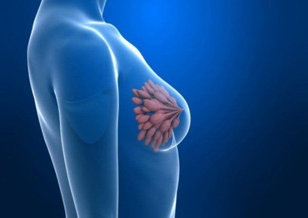 ensayos cáncer mama