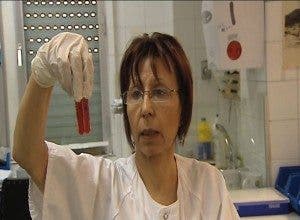 mieloma, sangre Investigadores españoles descubren una terapia que retrasa el mieloma