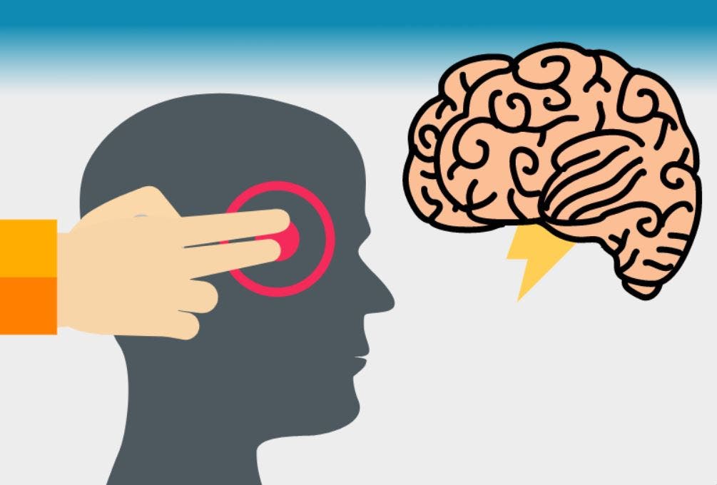 migraña crónica