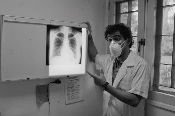 tuberculosis