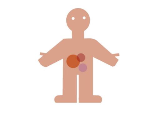 tumores neuroendocrinos