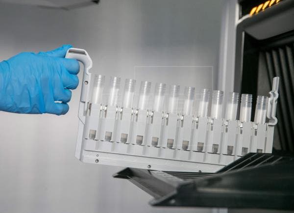 nueva cepa coronavirus