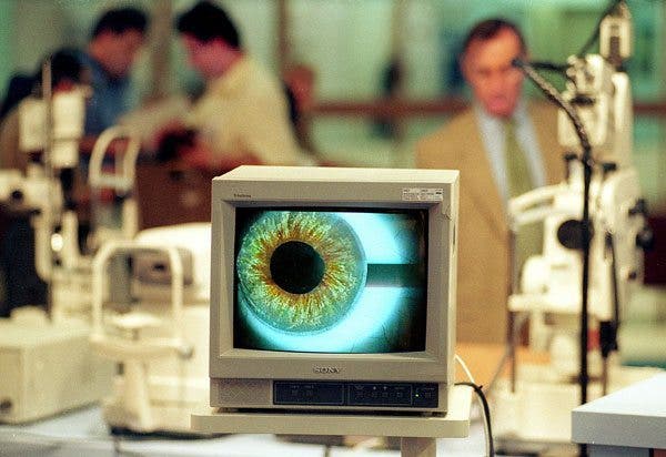 ojo