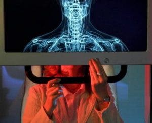 Reumatólogo osteoporosis