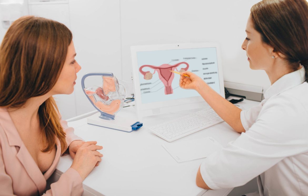 cáncer ovario