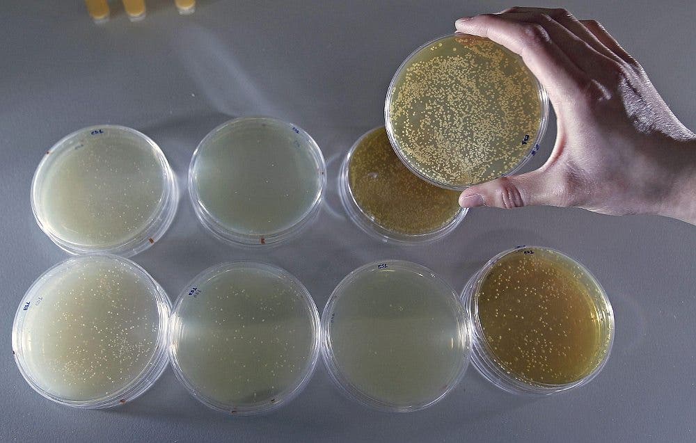 microbiología sujeta una placa con una muestra de probióticos.
