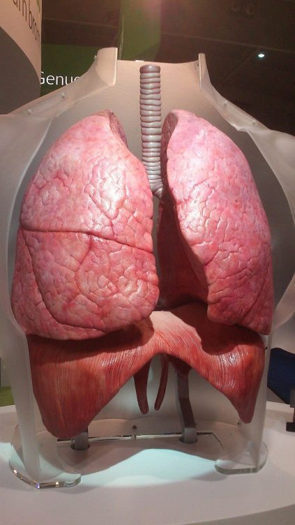 Cáncer de pulmón