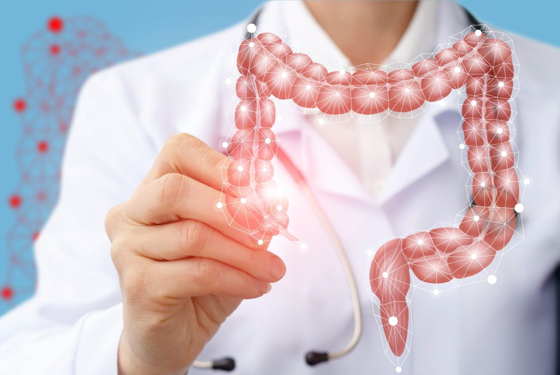 Cáncer de colon, colon, salud, hábitos saludables, alimentación, ejercicio, dolor, diagnóstico, colonoscopia, hemorragia, digestivo, tumores, pólipos, mortalidad, oncología