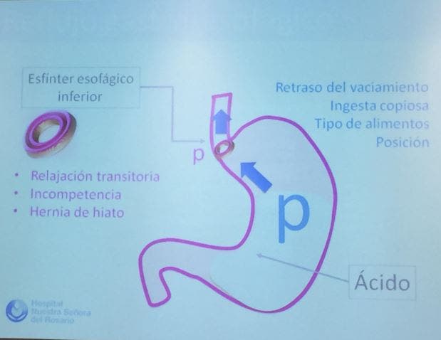 reflujo gastroesofágico