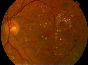 salud visual