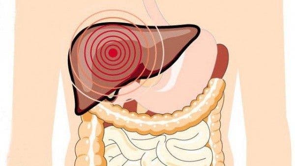 hepatitis C sovaldi
