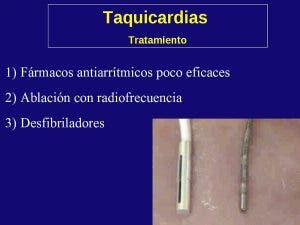 Tratamiento de las taquicardias