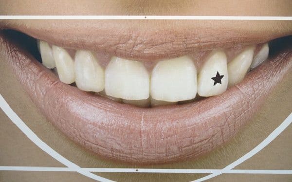 Tatuaje dientes