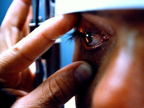 trasplante de cornea