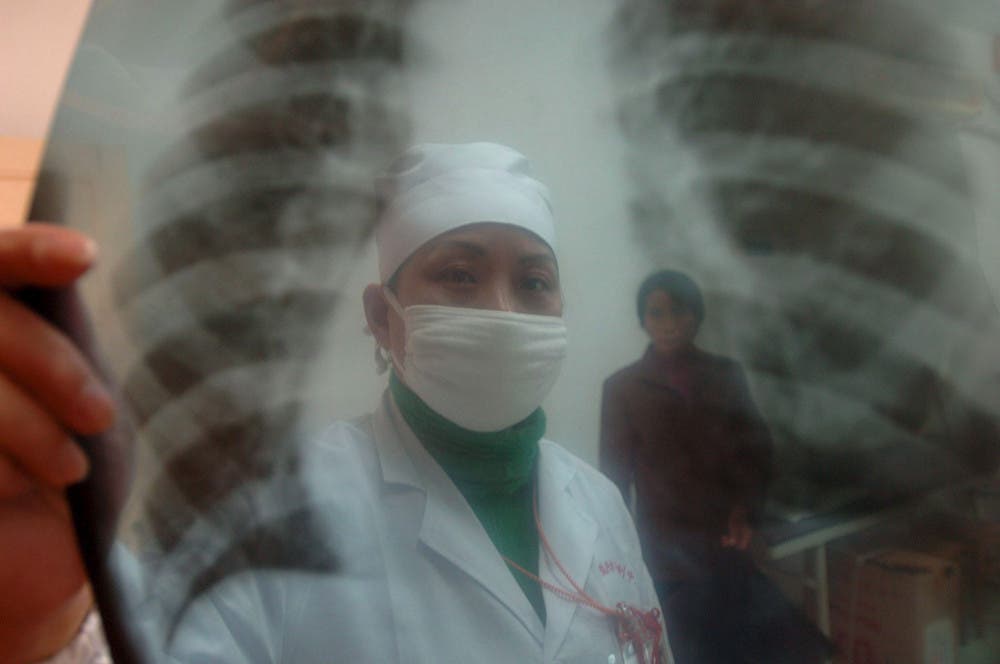 lucha tuberculosis pandemia