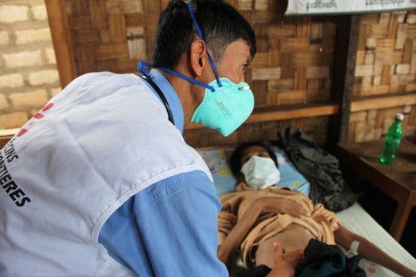 Tuberculosis