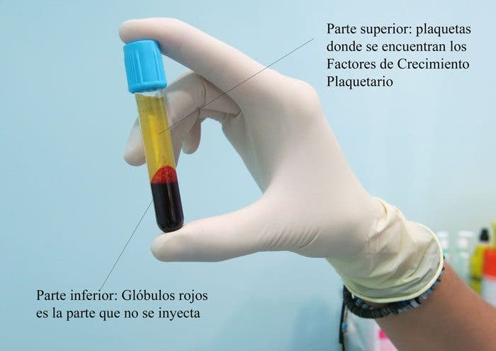 PLASMA SANGUINEO