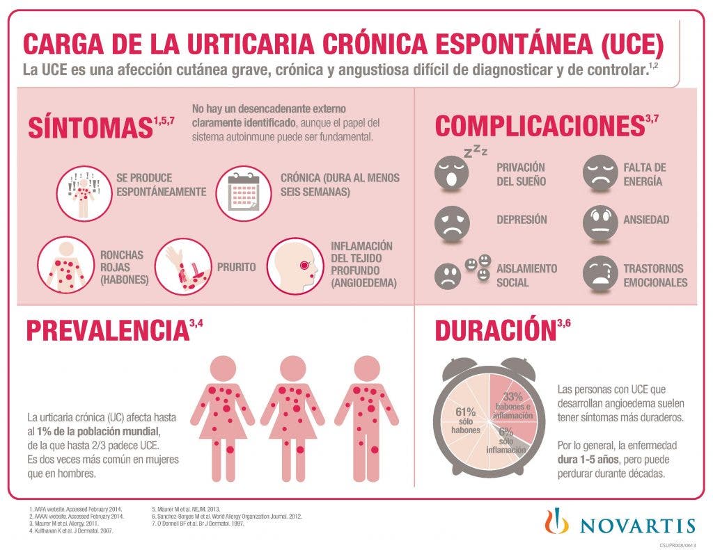 urticaria
