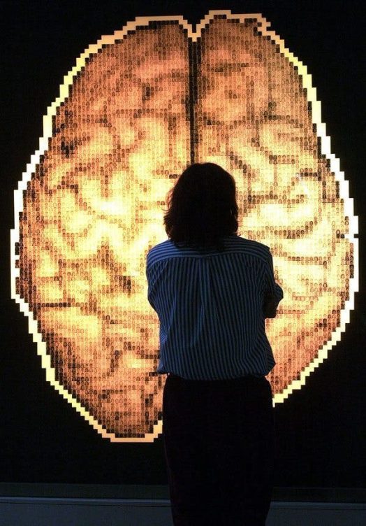 Epilepsia: desconexión transitoria