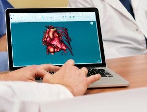 mujer, corazón, cuidado, cardiopatía, ejercicio, dieta, hábitos, ordenador, imagen, profesional