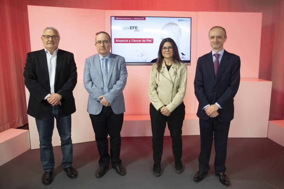alopecia y cáncer de piel